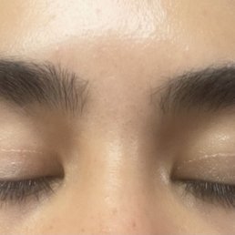 Before and after