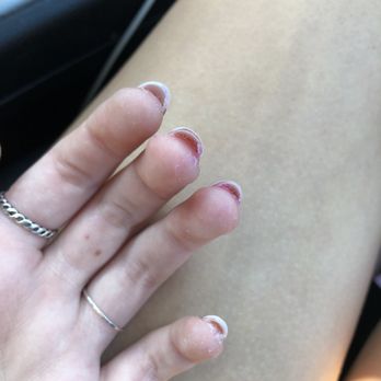 Shadow Nails - this is the nail polish and acrylic residue underneath my nails - Nail Salons Near Me - Seattle, Washington