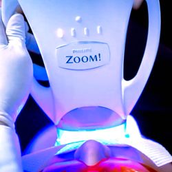 Baja Dental - Blanquemiento Dental , en Rosarito ZOOM WHITENING