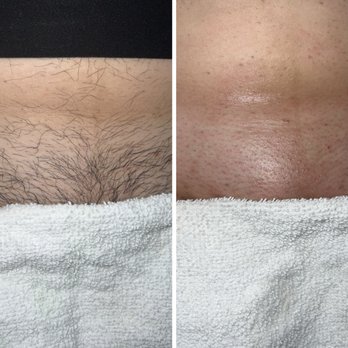 Pure Skin Facials - Brazilian Sugaring - Sugaring Near Me - La Habra, California Pure Skin Facials - Brazilian Sugaring - Sugaring Near Me - La Habra, California