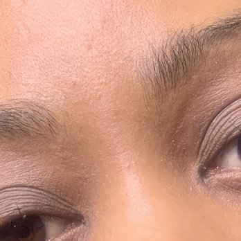 Face to Face Spa - My skin red irrated - Medical Spas Near Me - Austin, Texas