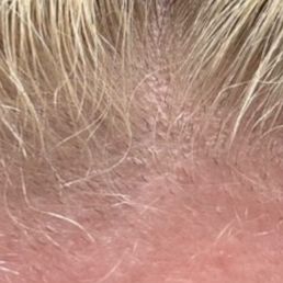 My hair was burned off and he claimed it was just "new growth". My hair was burned off and he claimed it was just "new growth".