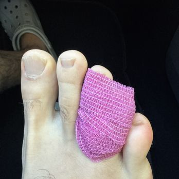 Exer Urgent Care - My toe healing - Urgent Care Near Me - Glendale, California Exer Urgent Care - My toe healing - Urgent Care Near Me - Glendale, California