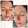 Photo of Skincare Habit