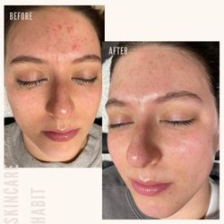 Skincare Habit
