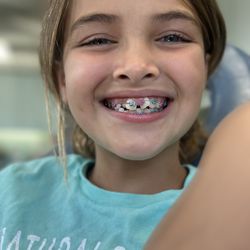 Thousand Oaks Orthodontics- Dr. Thomas C. Lee - First day she got her braces!