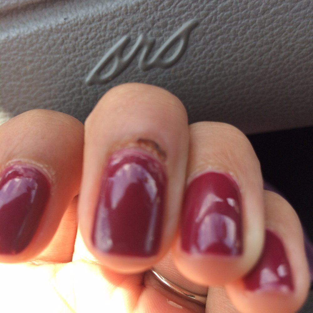 He cut my cuticle too deep. Not to mention my crappy paint job.