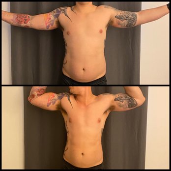 The Camp Transformation Center - Weight Loss Centers Near Me - Chula Vista, California The Camp Transformation Center - Weight Loss Centers Near Me - Chula Vista, California