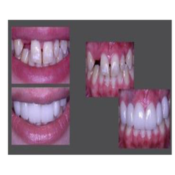 Dental Arts of Cherry Hills
