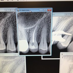 Endodontic Associates - One root canal later...