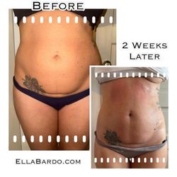 Ella Bardo Esthetics & Wellness Spa - Non-Invasive Body Contouring with Flux Red Non-Invasive Body Sculpting & Frequency Specific Microcurrent Scar reduction Skin tightening