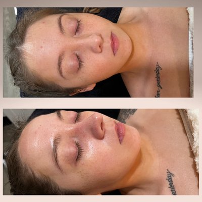 Facial photos - Collection of facial photos. Notice the glow on all my beautiful clients! Facial photos - Collection of facial photos. Notice the glow on all my beautiful clients!