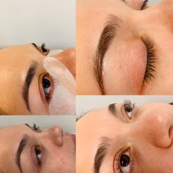 Top 10 Best Ingrown Hair Removal In Chicago Il Last Updated
