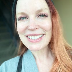 Réviance Plastic Surgery and Aesthetic Center - Me after seeing Amanda