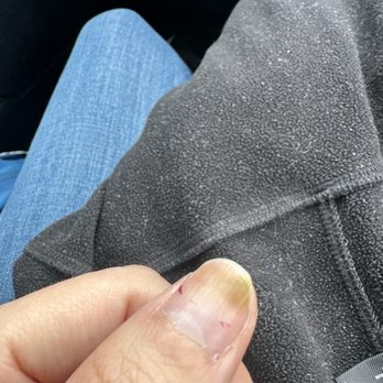 Q Nails & Spa - Nail bed burn or fungus? - Nail Salons Near Me - Madera, California Q Nails & Spa - Nail bed burn or fungus? - Nail Salons Near Me - Madera, California