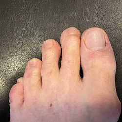 Venus Foot Spa - Blood the next morning From being stabbed while removing the cuticles.