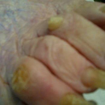 David - Podiatrists Near Me - Ruislip, XGL