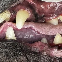 Clean teeth after photo Clean teeth after photo