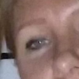 This pic shows my no hair brows with a previous persons solid line tattoo brows This pic shows my no hair brows with a previous persons solid line tattoo brows