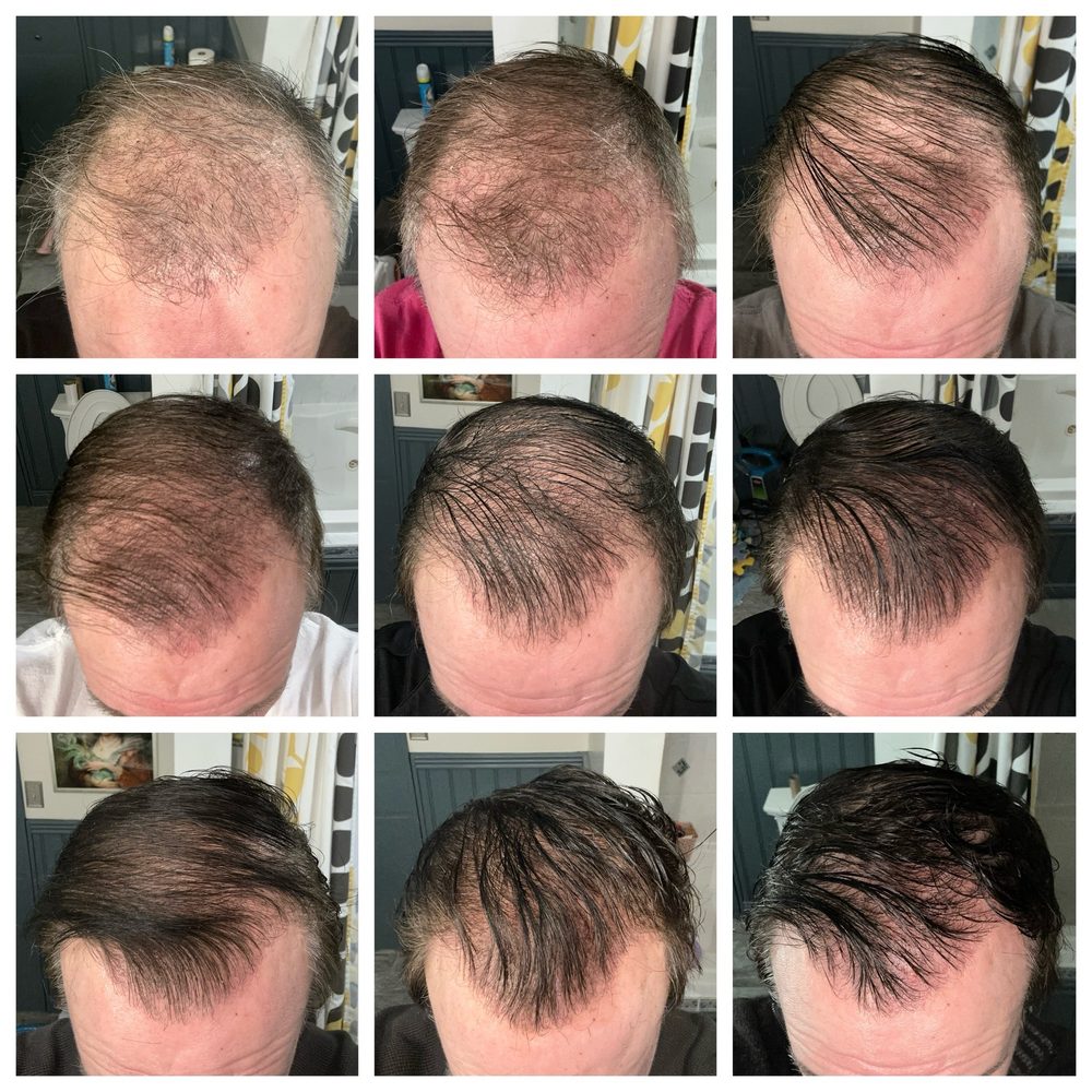 Bosley Hair Restoration & Transplant Logo