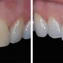 Keith A. Boenning, DDS