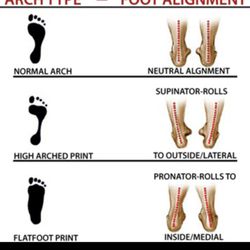 Ergo Good Orthotics - Everyone had different feet.
Orthotics help correct your foot to a more natural arch position.