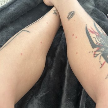 San Antonio Humane Society - Ringworm infestation on my whole body - Animal Shelters Near Me - San Antonio, Texas