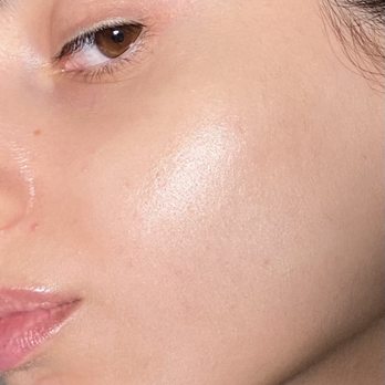 Scins Skins’ Aesthetic Clinic - Skin Transformation After - Aestheticians Near Me - Glendale, California Scins Skins’ Aesthetic Clinic - Skin Transformation After - Aestheticians Near Me - Glendale, California