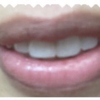 Beverly Hills Permanent Makeup - Before - Permanent Makeup Near Me - Beverly Hills, California Beverly Hills Permanent Makeup - Before - Permanent Makeup Near Me - Beverly Hills, California