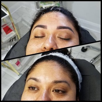 Bosch Beauty Bar - First session before and after. Pic 1/3 - Eyelash Service Near Me - Bethesda, Maryland