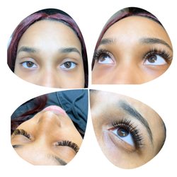 simple skincare laser and spa