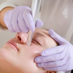 No Filter Aesthetics - Pigmentation, rosacea, acne, open pores, scarring, milia, wrinkles, sun damage, fragile capillaries and premature ageing.