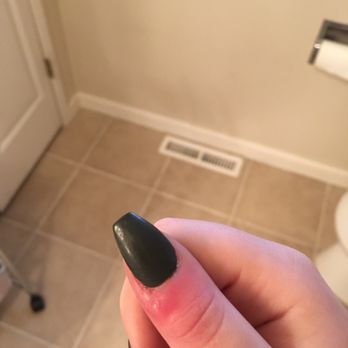 Foxy Nails - Infected nail - Nail Salons Near Me - Spokane, Washington Foxy Nails - Infected nail - Nail Salons Near Me - Spokane, Washington