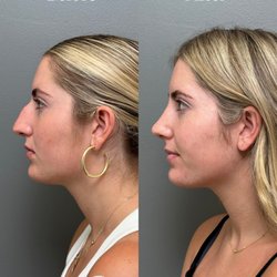 Taylor Pollei, MD - Facial Plastic Surgeon