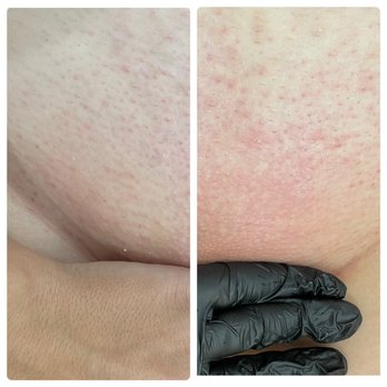 Bella Bliss By B - Brazilian after & before jelly mask - Nail Salons Near Me - Riverview, Florida