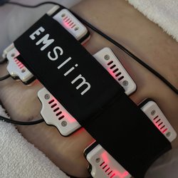 FemmeVaniteuse - Laser Lipo (skin tightening + dissolves fat)