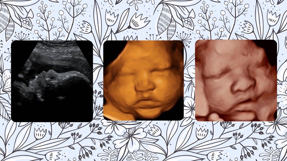 FIRST LOOK IMAGING Ultrasound Imaging Centers Bethlehem, PA Phone Number Yelp