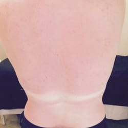 Mountainside Spa - On the mend after Mountainside Spa's Calm Skin treatment.