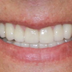 Kristen Brittain, DDS PA - After