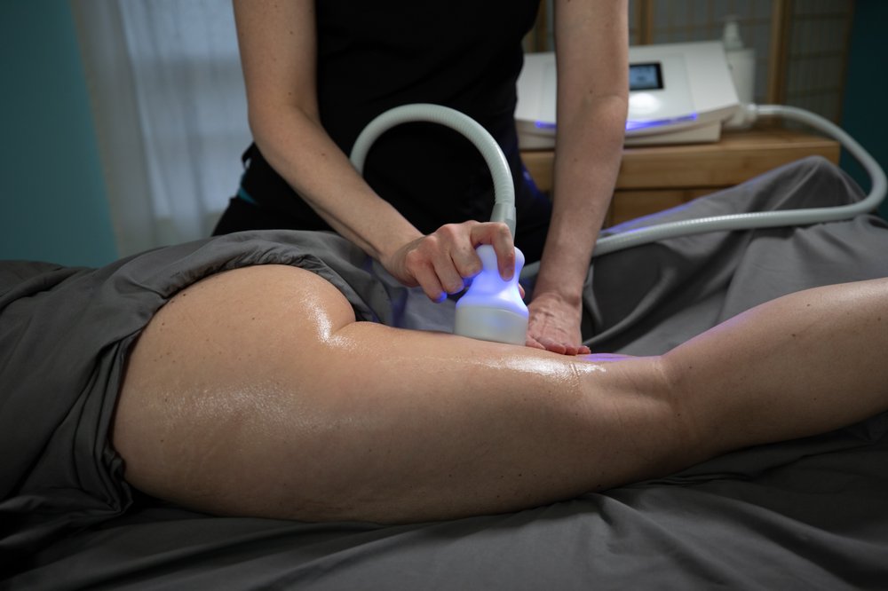 Ultra Cryo & Recovery S. Lakeland Image