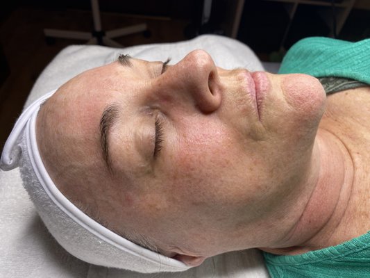 Mirame Skin Treatments by null