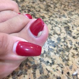 This is PUS coming out of my Toe ladies! This is PUS coming out of my Toe ladies!
