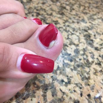 In Style Nail Spa - This is PUS coming out of my Toe ladies! - Nail Salons Near Me - Paramount, California In Style Nail Spa - This is PUS coming out of my Toe ladies! - Nail Salons Near Me - Paramount, California