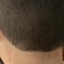 Cuts
