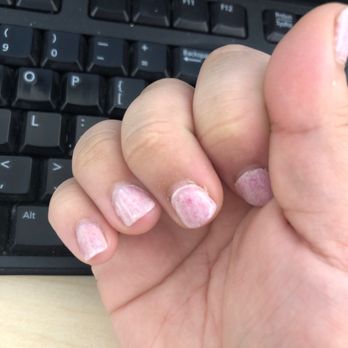 The Nail Lounge - middle finger - the gel when first done was on my cuticle (they weren't cut well either) ring finger: once again got gel in my nail bed - Nail Salons Near Me - Moore, Oklahoma