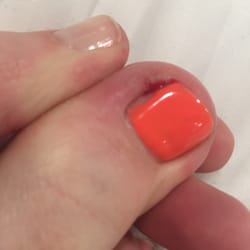 Fashion Nails - 3 days later and my toe is still messed up. DO NOT GO HERE!