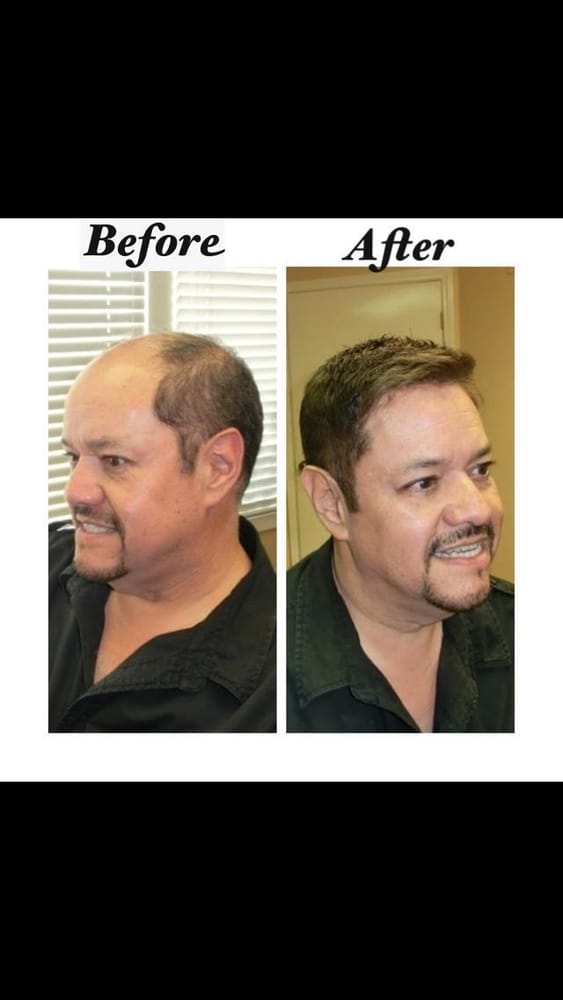 APOLLO HAIR SYSTEMS Updated August 2024 23361 El Toro Rd, Lake