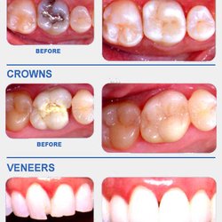 Gourgen Almasi, DDS - Restoration