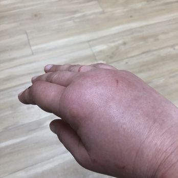 Accelerated Urgent Care - Why should I buy over-the-counter pain medication when I have insurance? - Urgent Care Near Me - Bakersfield, California Accelerated Urgent Care - Why should I buy over-the-counter pain medication when I have insurance? - Urgent Care Near Me - Bakersfield, California