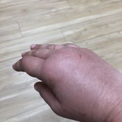 Accelerated Urgent Care - Why should I buy over-the-counter pain medication when I have insurance?